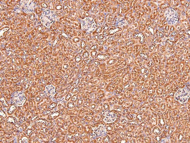 Phospho-Claudin 1 (Tyr210) Antibody in Immunohistochemistry (Paraffin) (IHC (P))