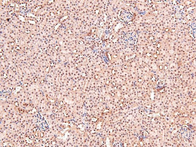 Phospho-CRMP1 (Tyr504) Antibody in Immunohistochemistry (Paraffin) (IHC (P))