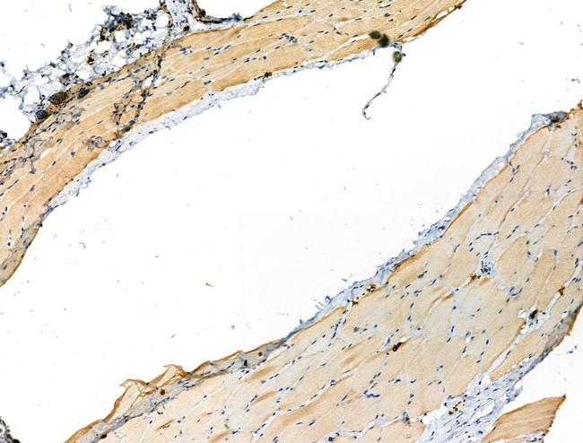 Phospho-RCAN1 (Ser163) Antibody in Immunohistochemistry (Paraffin) (IHC (P))