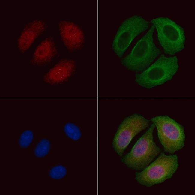 Phospho-FOXO1 (Ser249) Antibody in Immunocytochemistry (ICC/IF)