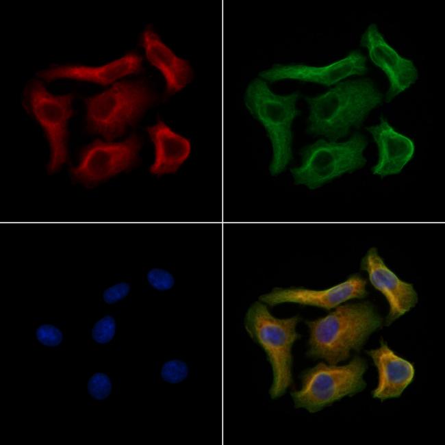 Phospho-MAP2 (Ser136) Antibody in Immunocytochemistry (ICC/IF)