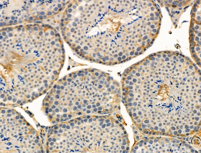 Phospho-MKP3 (Ser197) Antibody in Immunohistochemistry (Paraffin) (IHC (P))