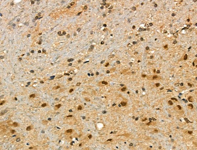 Phospho-p21 (Ser130) Antibody in Immunohistochemistry (Paraffin) (IHC (P))