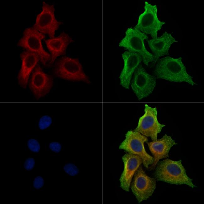 Phospho-PTP1B (Tyr66) Antibody in Immunocytochemistry (ICC/IF)