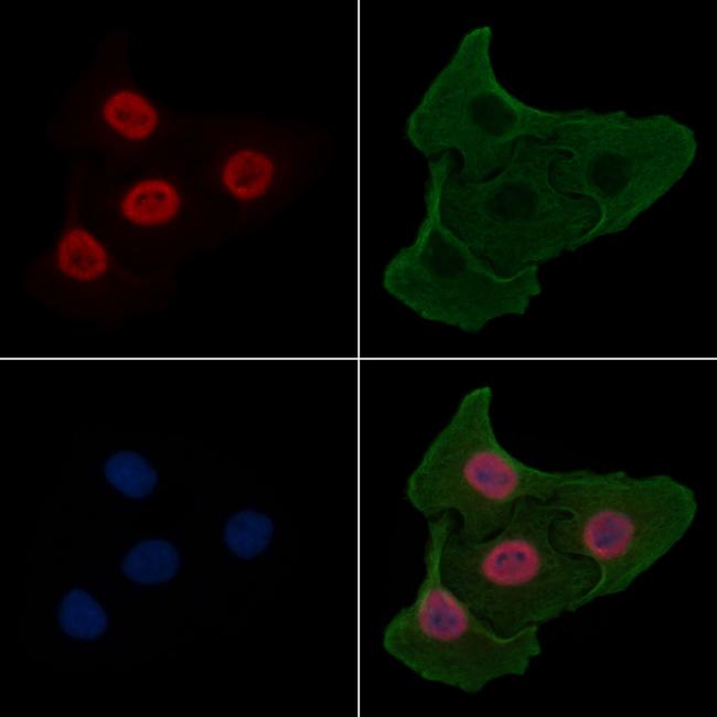 Phospho-USP28 (Ser714) Antibody in Immunocytochemistry (ICC/IF)