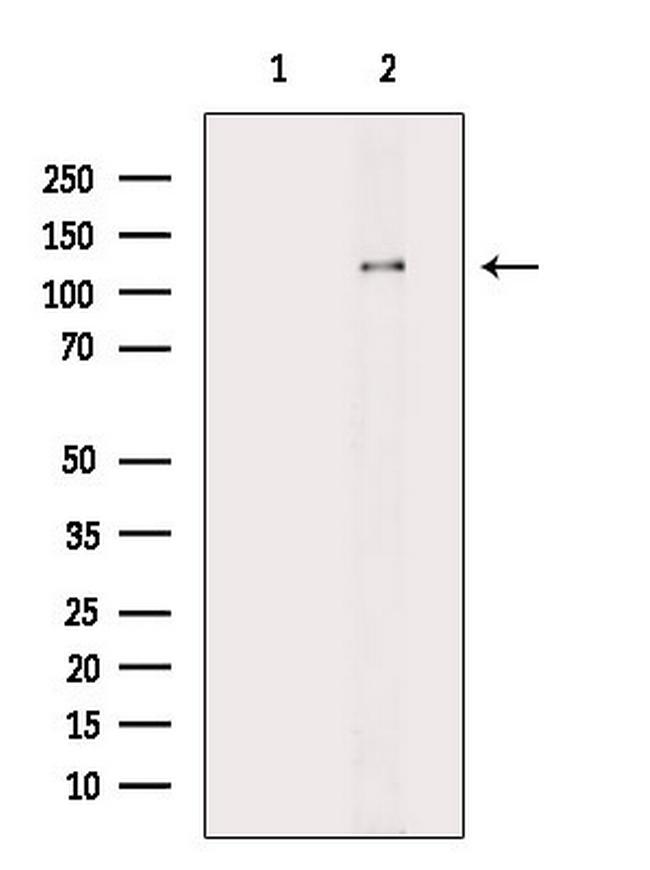 Phospho-ACK1 (Tyr859, Tyr860) Antibody in Western Blot (WB)