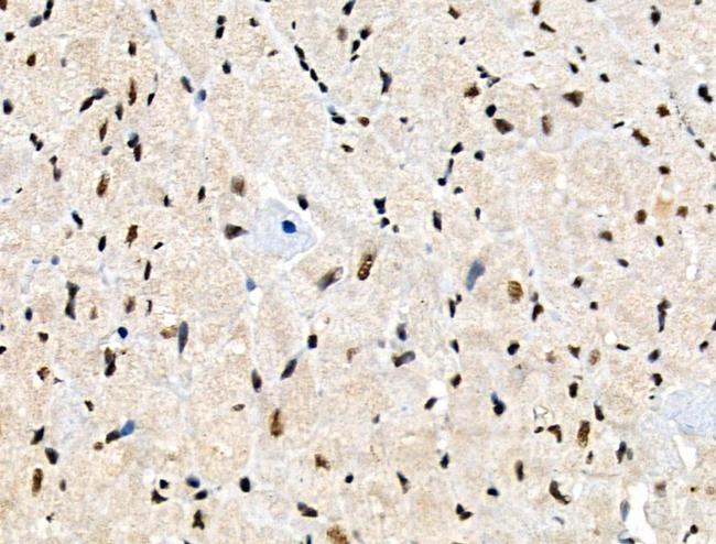 Phospho-PFKFB2 (Ser466) Antibody in Immunohistochemistry (Paraffin) (IHC (P))