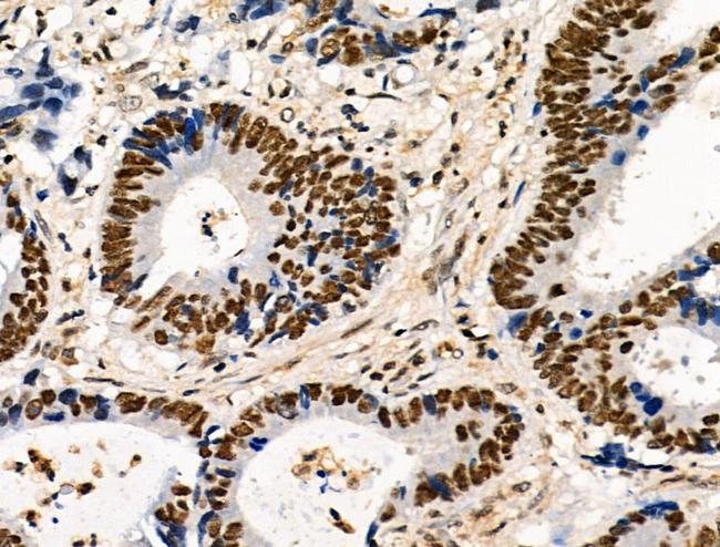 Phospho-POLR2A (Ser1616) Antibody in Immunohistochemistry (Paraffin) (IHC (P))