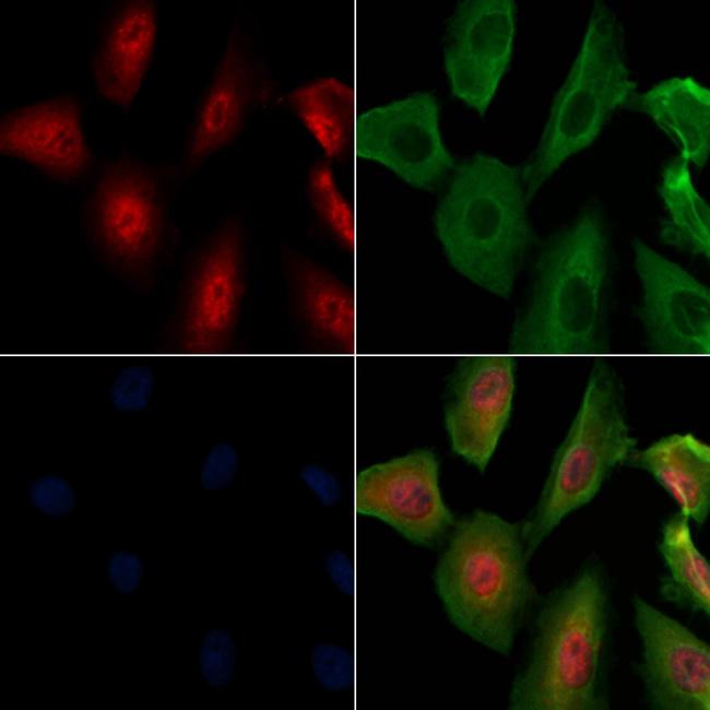 Phospho-ALOX5 (Ser664) Antibody in Immunocytochemistry (ICC/IF)