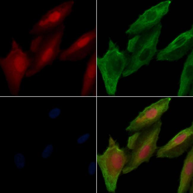 Phospho-Btk (Ser179) Antibody in Immunocytochemistry (ICC/IF)