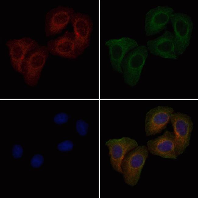 Phospho-ITGB1 (Tyr783) Antibody in Immunocytochemistry (ICC/IF)