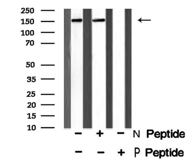 Phospho-Met (Tyr1365) Antibody in Western Blot (WB)