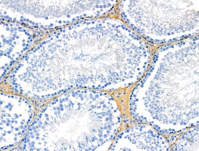 Phospho-PLCG1 (Ser1248) Antibody in Immunohistochemistry (Paraffin) (IHC (P))