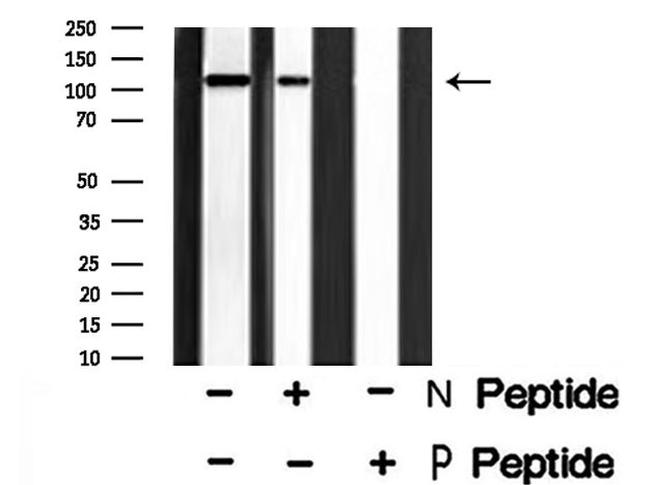 Phospho-Rb (Thr373) Antibody in Western Blot (WB)