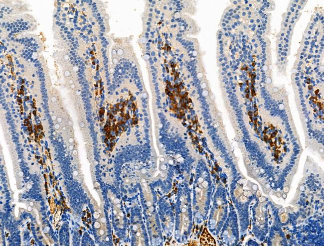 Phospho-ROCK2 (Tyr722) Antibody in Immunohistochemistry (Paraffin) (IHC (P))