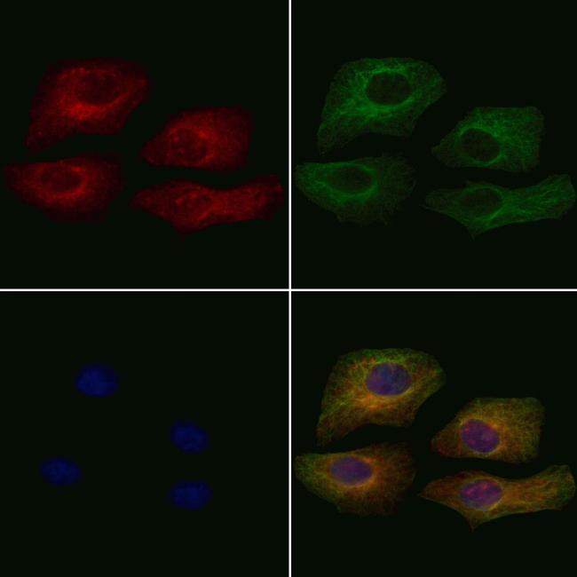 Phospho-Vinculin (Tyr1133, Tyr1065) Antibody in Immunocytochemistry (ICC/IF)