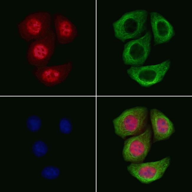 Phospho-Androgen Receptor (Ser792) Antibody in Immunocytochemistry (ICC/IF)