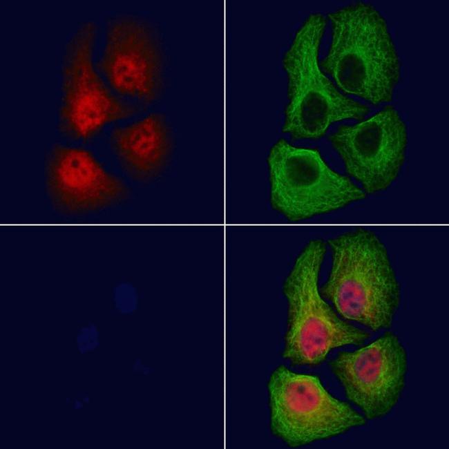 Phospho-Androgen Receptor (Ser310) Antibody in Immunocytochemistry (ICC/IF)