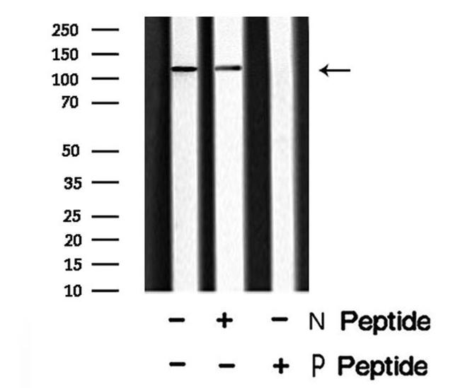 Phospho-EphA1 (Tyr599) Antibody in Western Blot (WB)