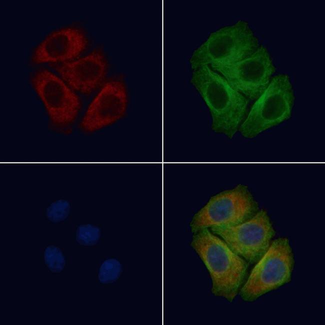 Phospho-EphB6 (Tyr645) Antibody in Immunocytochemistry (ICC/IF)