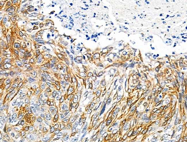 Phospho-FGFR3 (Tyr724) Antibody in Immunohistochemistry (Paraffin) (IHC (P))