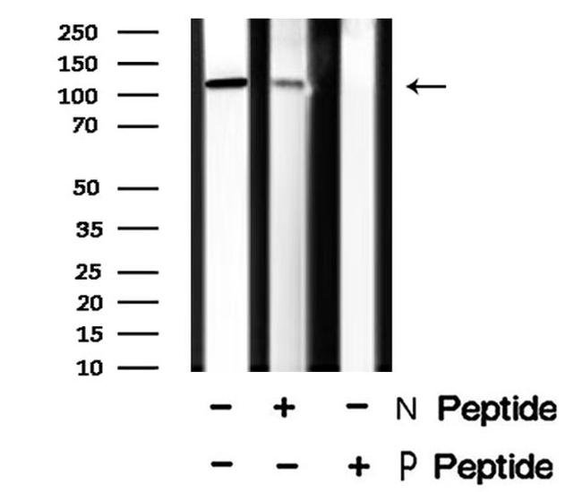 Phospho-ROR2 (Ser449) Antibody in Western Blot (WB)