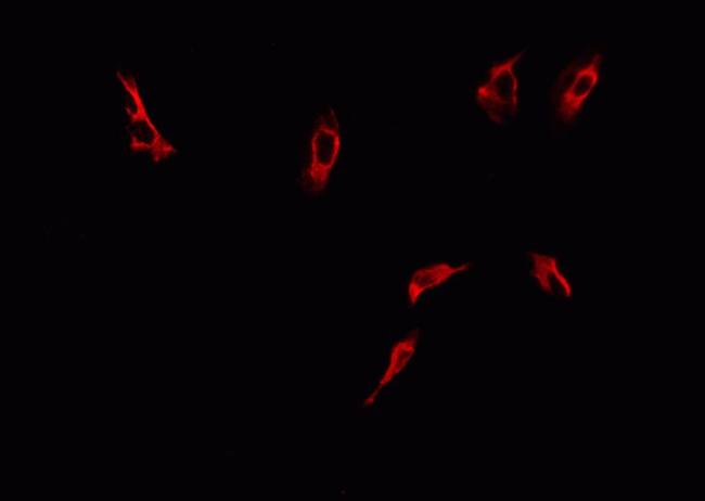 Phospho-DNM1L (Ser616) Antibody in Immunocytochemistry (ICC/IF)