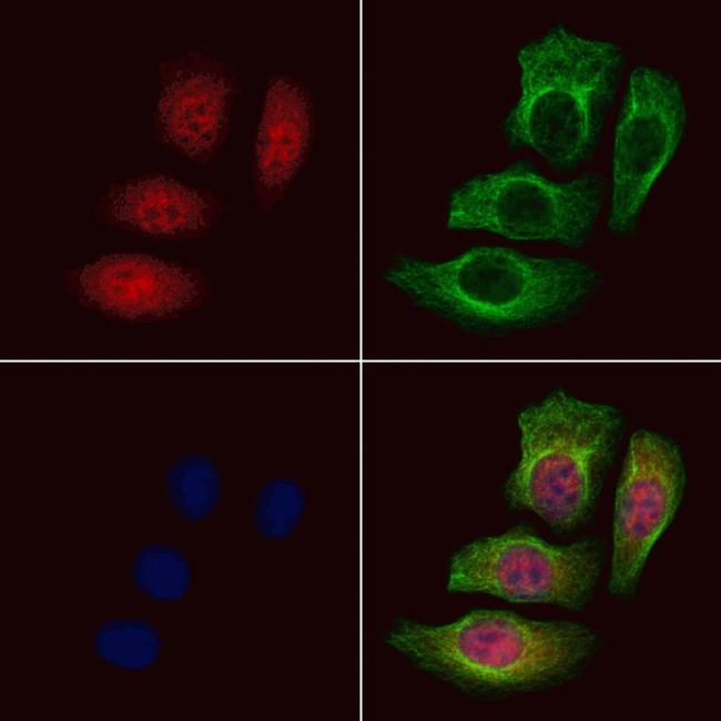 Phospho-NPM1 (Thr237) Antibody in Immunocytochemistry (ICC/IF)