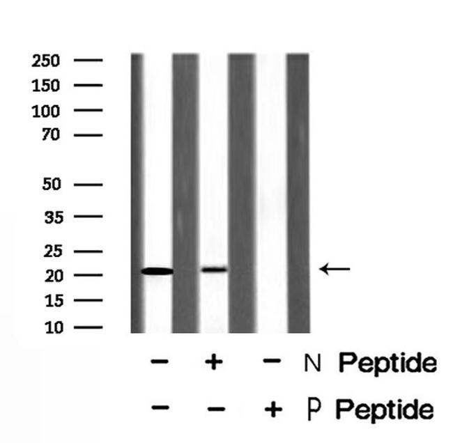 Phospho-p21 (Thr57) Antibody in Western Blot (WB)