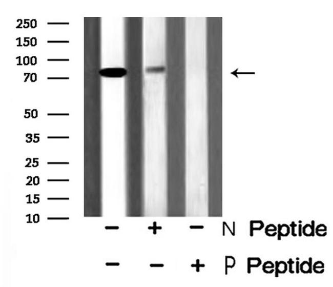 Phospho-p73 (Ser388) Antibody in Western Blot (WB)