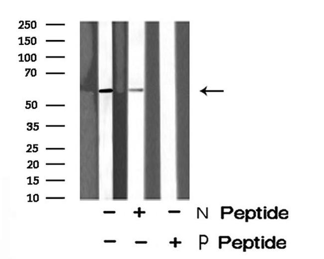 Phospho-PNK (Ser114) Antibody in Western Blot (WB)