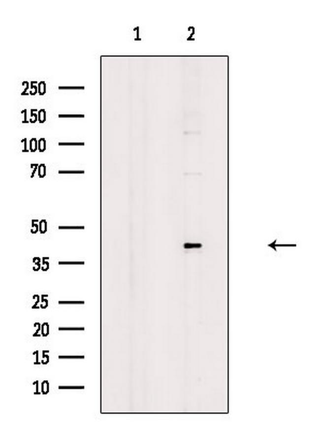 Phospho-FEN1 (Ser187) Antibody in Western Blot (WB)