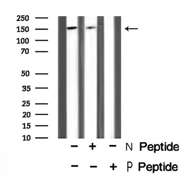 Phospho-RON (Tyr1353) Antibody in Western Blot (WB)