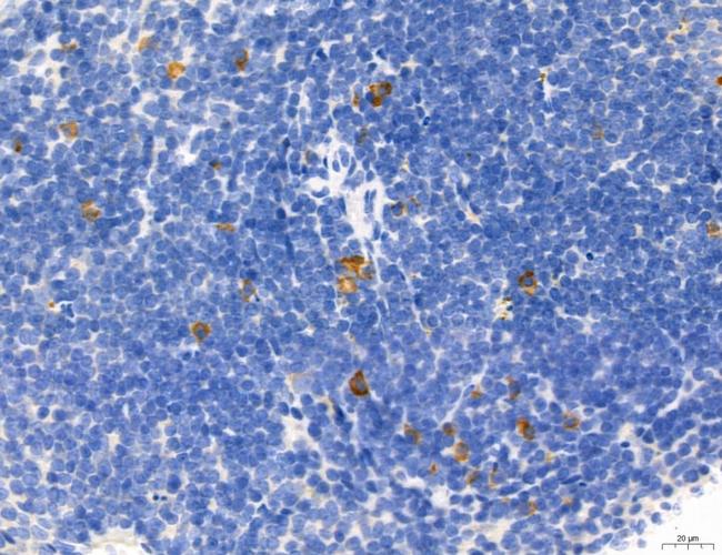 Phospho-Axl (Tyr702) Antibody in Immunohistochemistry (Paraffin) (IHC (P))