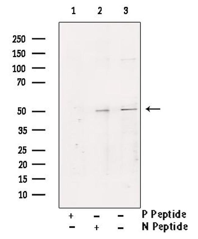 Phospho-YBX1 (Ser102) Antibody in Western Blot (WB)