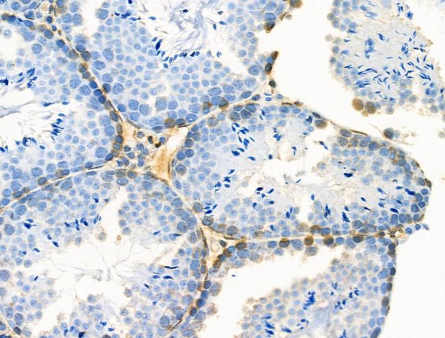 Phospho-Creatine Kinase BB (Ser199) Antibody in Immunohistochemistry (Paraffin) (IHC (P))