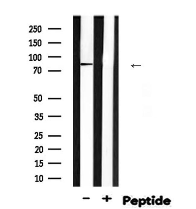 Phospho-EZH2 (Ser474) Antibody in Western Blot (WB)