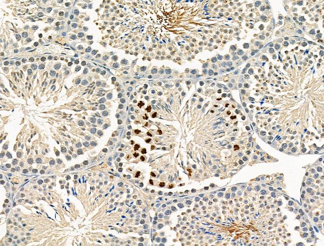 Phospho-EZH2 (Ser476) Antibody in Immunohistochemistry (Paraffin) (IHC (P))