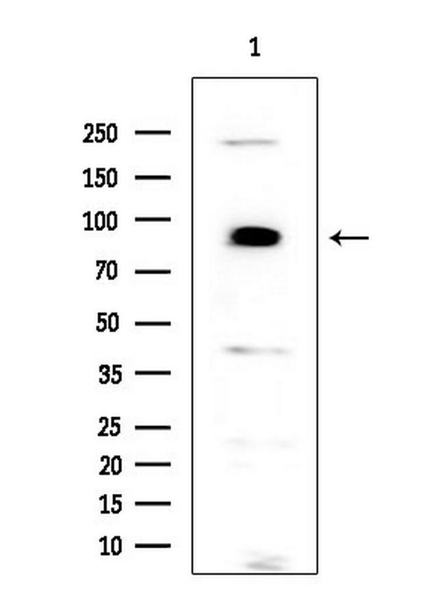 PKD2 Antibody in Western Blot (WB)