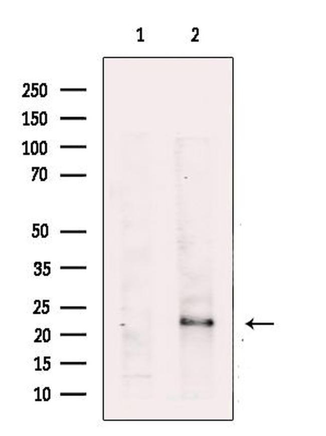 RRAS Antibody in Western Blot (WB)