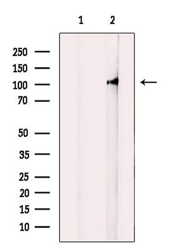 MLK3 Antibody in Western Blot (WB)