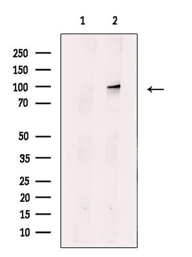 PRK1/PRK2 Antibody in Western Blot (WB)