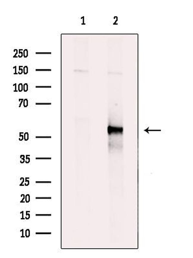 SMAD1/SMAD9 Antibody in Western Blot (WB)