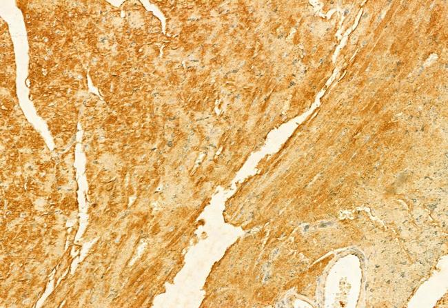 FIS1 Antibody in Immunohistochemistry (Paraffin) (IHC (P))