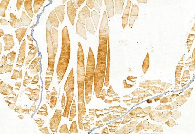 IFT81 Antibody in Immunohistochemistry (Paraffin) (IHC (P))