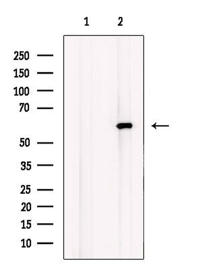 LPCAT1 Antibody in Western Blot (WB)