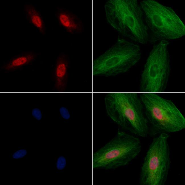 SGTA Antibody in Immunocytochemistry (ICC/IF)