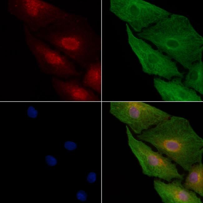 COMMD1 Antibody in Immunocytochemistry (ICC/IF)