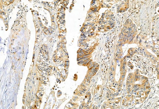 DHRS3 Antibody in Immunohistochemistry (Paraffin) (IHC (P))