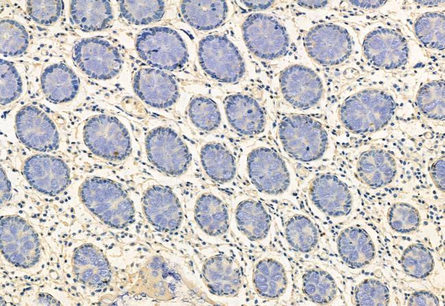 FKBP10 Antibody in Immunohistochemistry (Paraffin) (IHC (P))